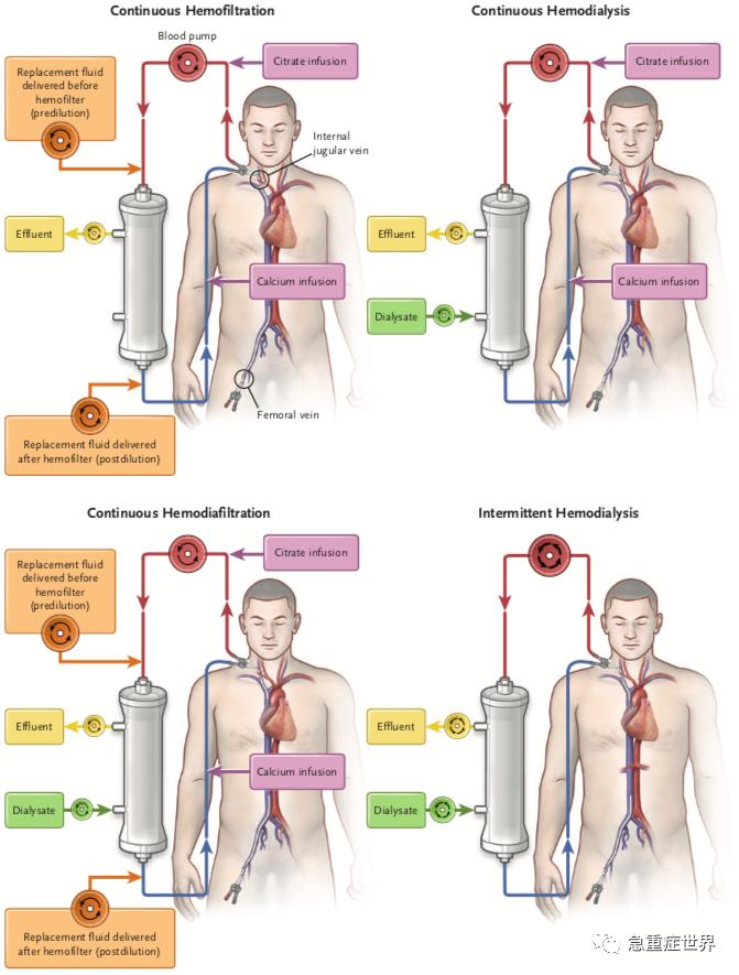 万能猪人工肾最新消息，制作指南与技能学习