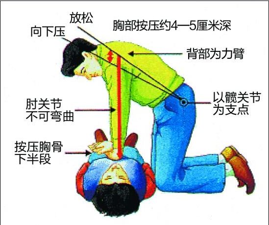 新生儿心肺复苏最新版，拯救生命的最新指南